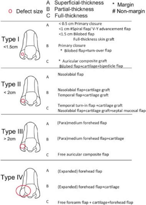 CLASSIFICATION AND TREATMENT ALGORITHM FOR NASAL ALAR DEFECT