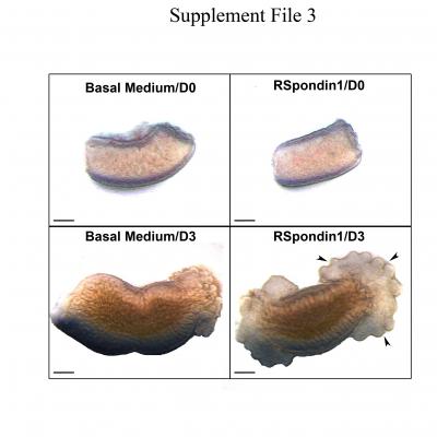 Bowel Bridging (1 of 2)