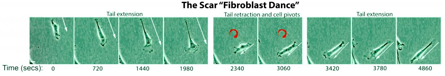 Fibroblasts dancing in formation