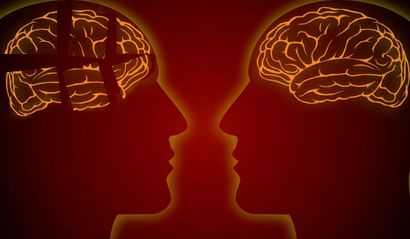 'Why Can't a Woman Be More Like a Man?' -- Studying Gender's Role in Alzheimer's Disease 2