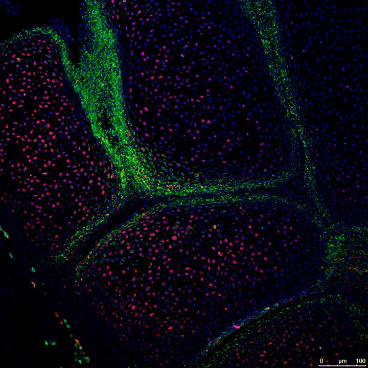 Developing Metacarpal Joint