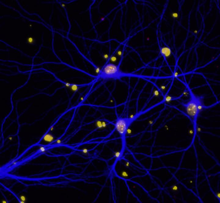 BRCA1 in Neurons