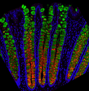 Goblet Cell