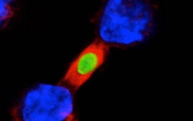 Macrophage and Pathogen, University of California San Diego