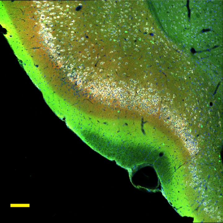 Microscopy Image -- Piriform Cortex