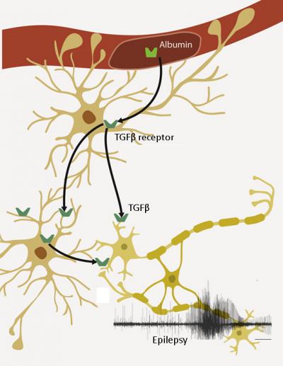 Preventing Epilepsy after Severe Head Trauma