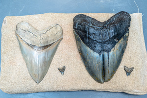 Normal versus deformed teeth