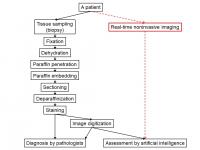 Schema of Novel Cancer Tissue Diagnosis by Our Imaging Method