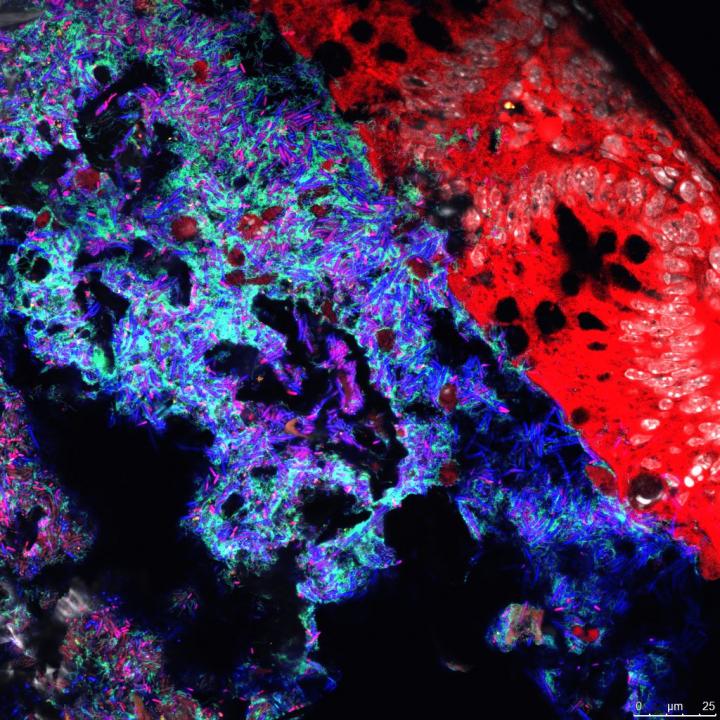 Mucispirillum and Salmonella in the Intestinal Lumen