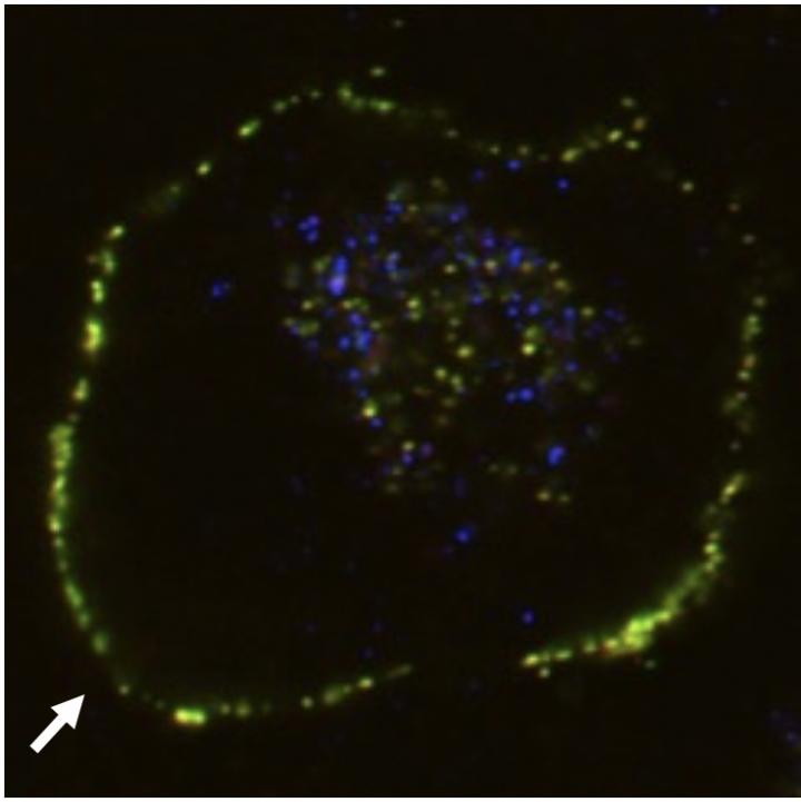 Fluorescence-Labelled Clusterin-Aberrant Protein Complex