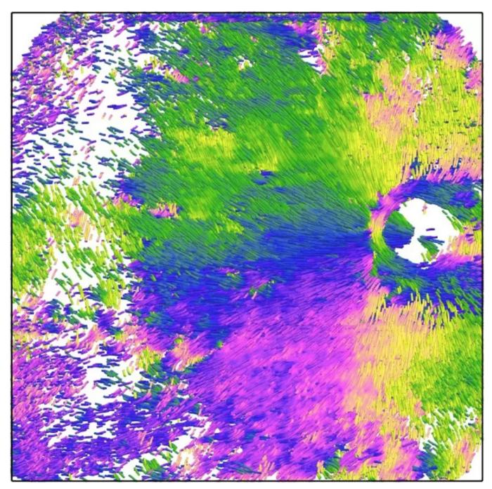 Visualization of the orientation and density of structural fibers in the sclera, the outermost eye layer