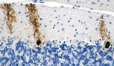 Mouse Cerebellum after Glycogen Accumulation