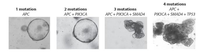 The development of colorectal cancer, modeled with intestinal organoids