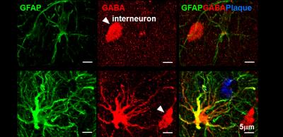 GABA Accumulation in Reactive Astrocyte