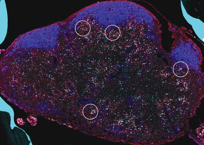 Mouse lymph node with hotspots [IMAGE] | EurekAlert! Science News Releases