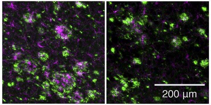 A novel drug reduces amyloid plaques and neuroinflammation in mice
