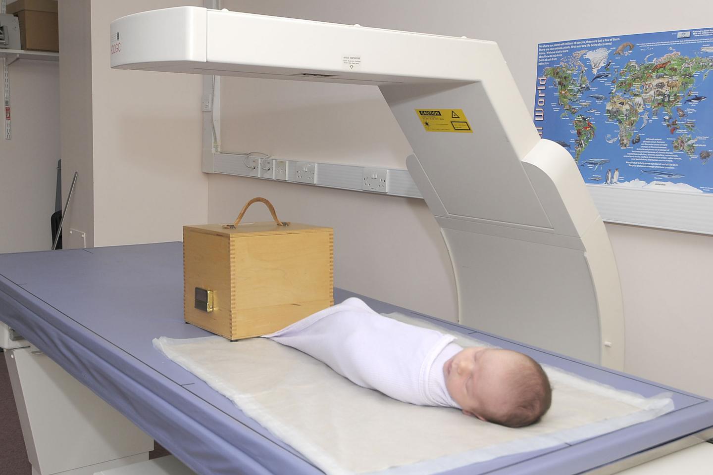 What Is a DEXA Scan? - University Health News