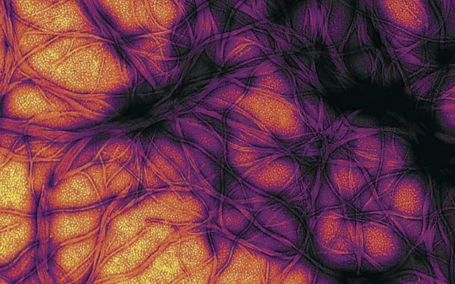 Prions in E. Coli, NIAID