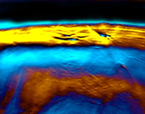 Brown Adipose Tissue Made Transparent