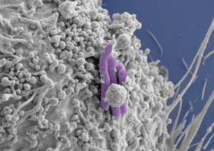 Image of a macrophage (grey) infected with M. tuberculosis (pseudocolored purple), the bacilli bacteria that cause TB