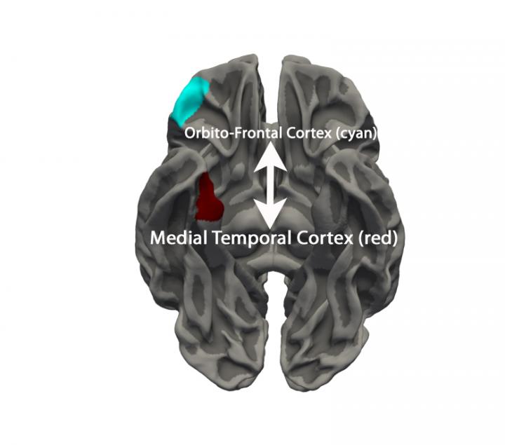 Image of Brain