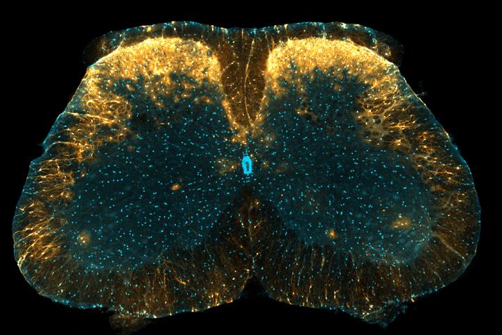 Spinal astrocytes