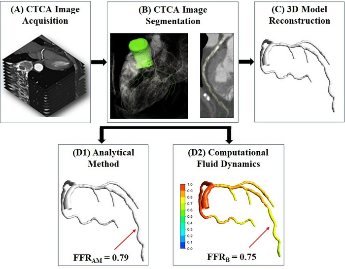 Calculation of non-invasive fractional flow reserve