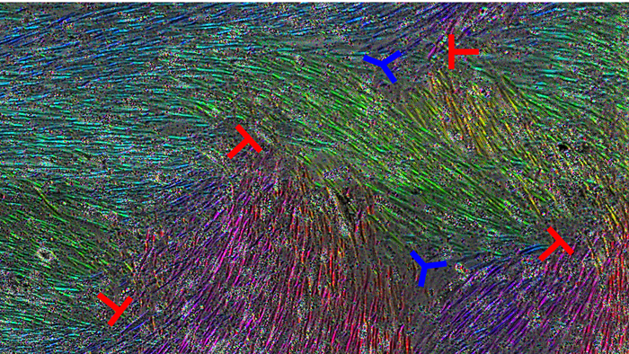 Mesothelial cells with colors indicating direction of cell orientation