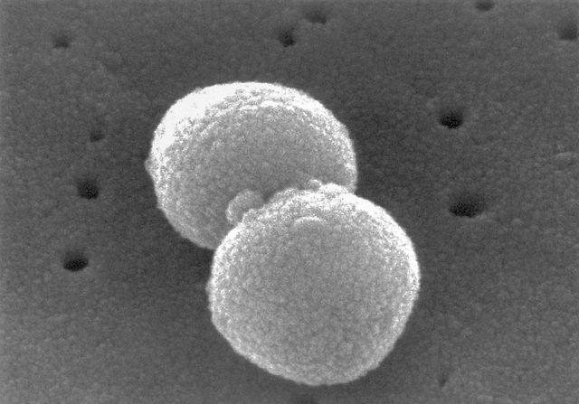 Scanning Electron Micrograph of <em>Streptococcus pneumoniae</em>