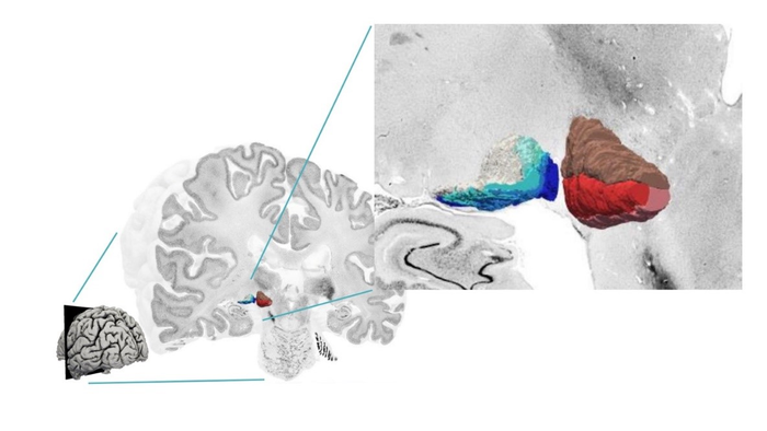 Metathalamus zoomed in