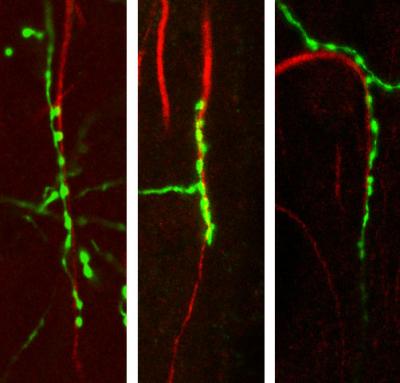 Chandelier Cells Inhibit Nearby Excitatory Neurons