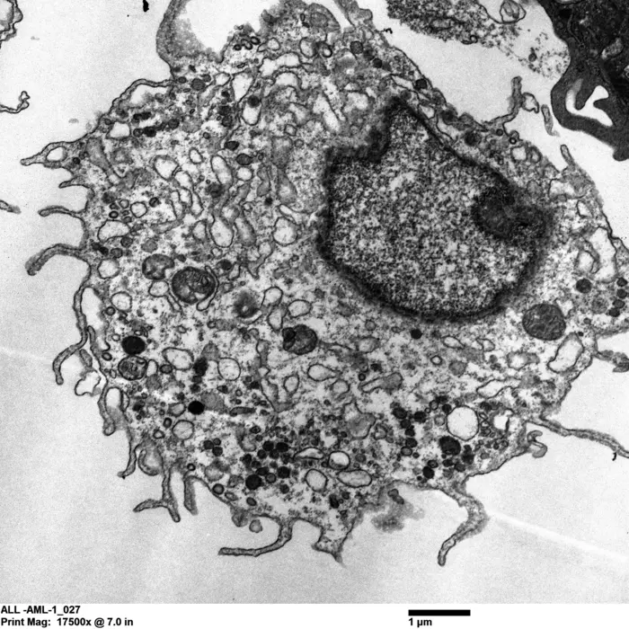 AML cell TEM image