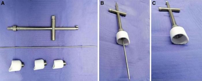 Traditional and modified uterine manipulator for patients with early-stage cervical cancer