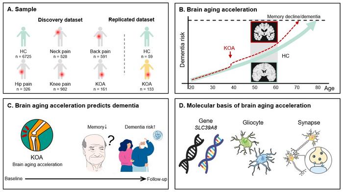 Using brain MRI data from more than 9000 individuals, researchers identified a distinct heritable pattern linking knee osteoarthritis to dementia