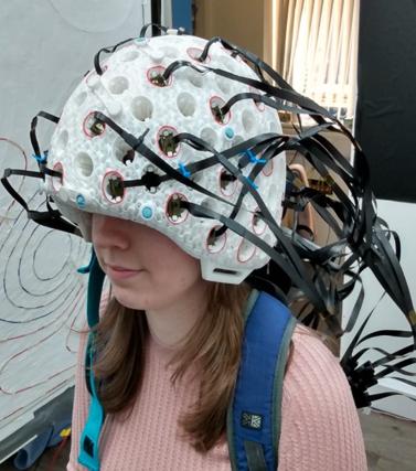 Rigid Whole Head Brain Scanner