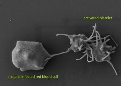 Platelets Attack Malaria Paras [IMAGE] | EurekAlert! Science News Releases