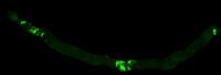 Blocked Tumor-Like Growth in <i>Drosophila</i> Intestine