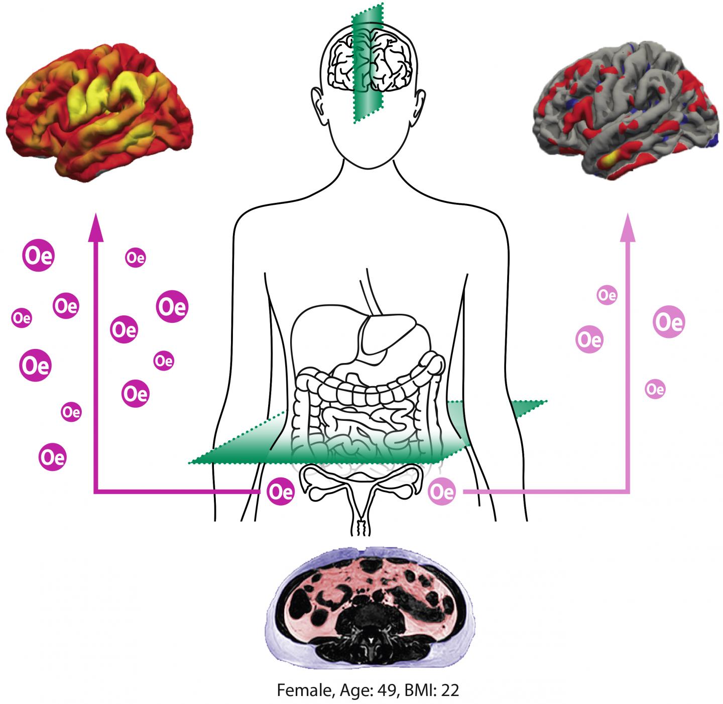 Sexual Hormone Oestradiol Protects Female Brain in Mid-Life