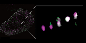 Actin affects the spread of cancer in several ways