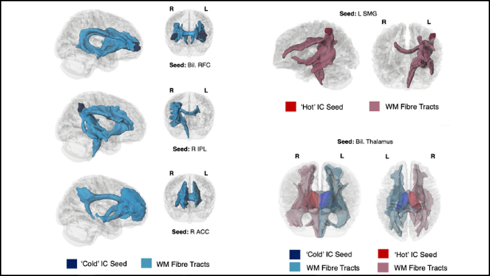 How Preschoolers Brains Develop Self-Control