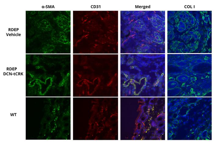 The drug inhibits progression of epidermolysis bullosa in skin.