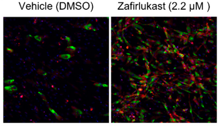 Zafirlukast induces the production of brown adipocyte tissue