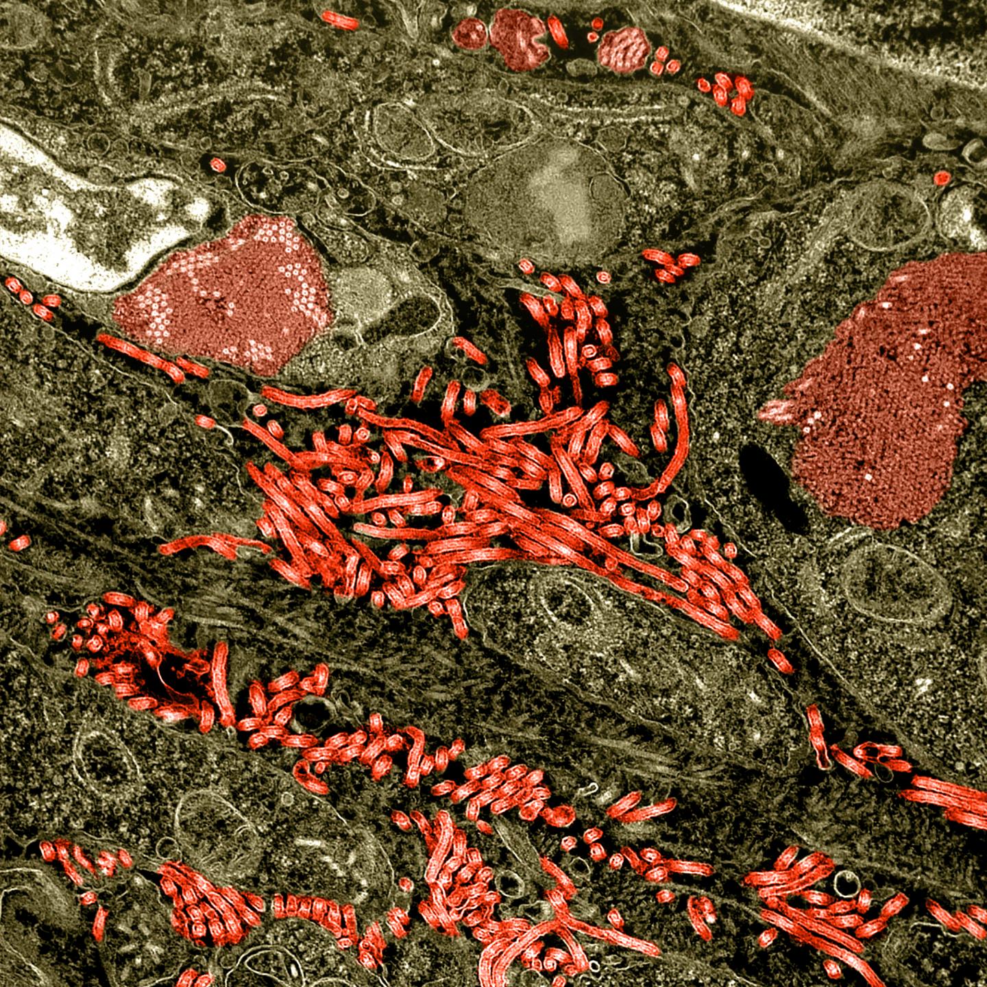 Colorized Transmission Electron Micrograph of the Ovary from a Nonhuman Primate Infected with Ebola 