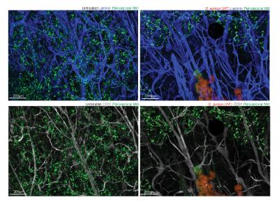 Golden Staph Paralyzes Our Immune Defenses