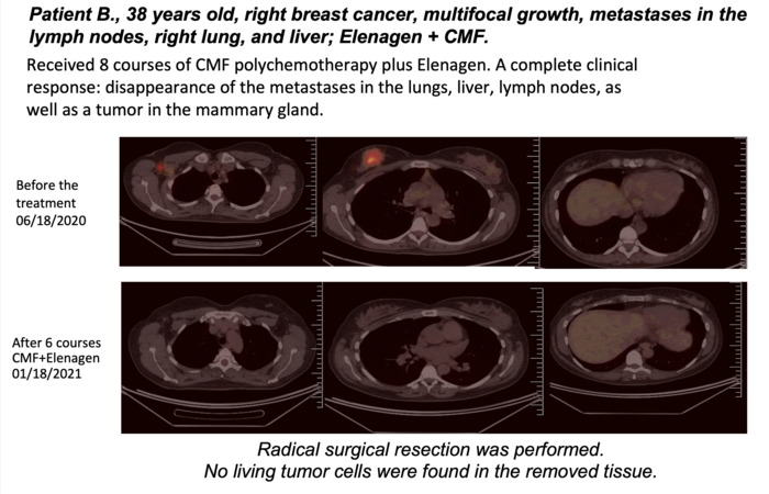 Preliminary clinical results in deadly forms of breast and ovarian cancers