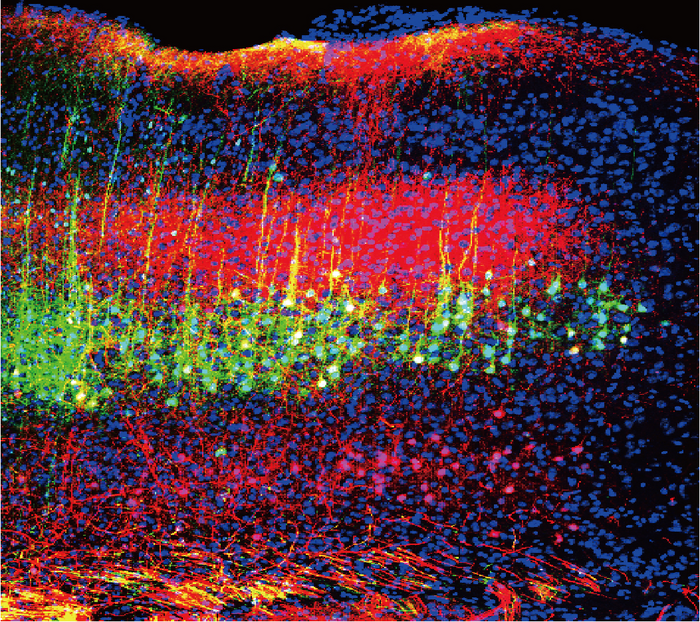 Neurons in the mouse auditory cortex