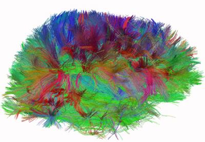 Diffusion Spectrum Image of Human Brain