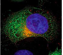 HIV Env Interacting with GFP-FIP1C