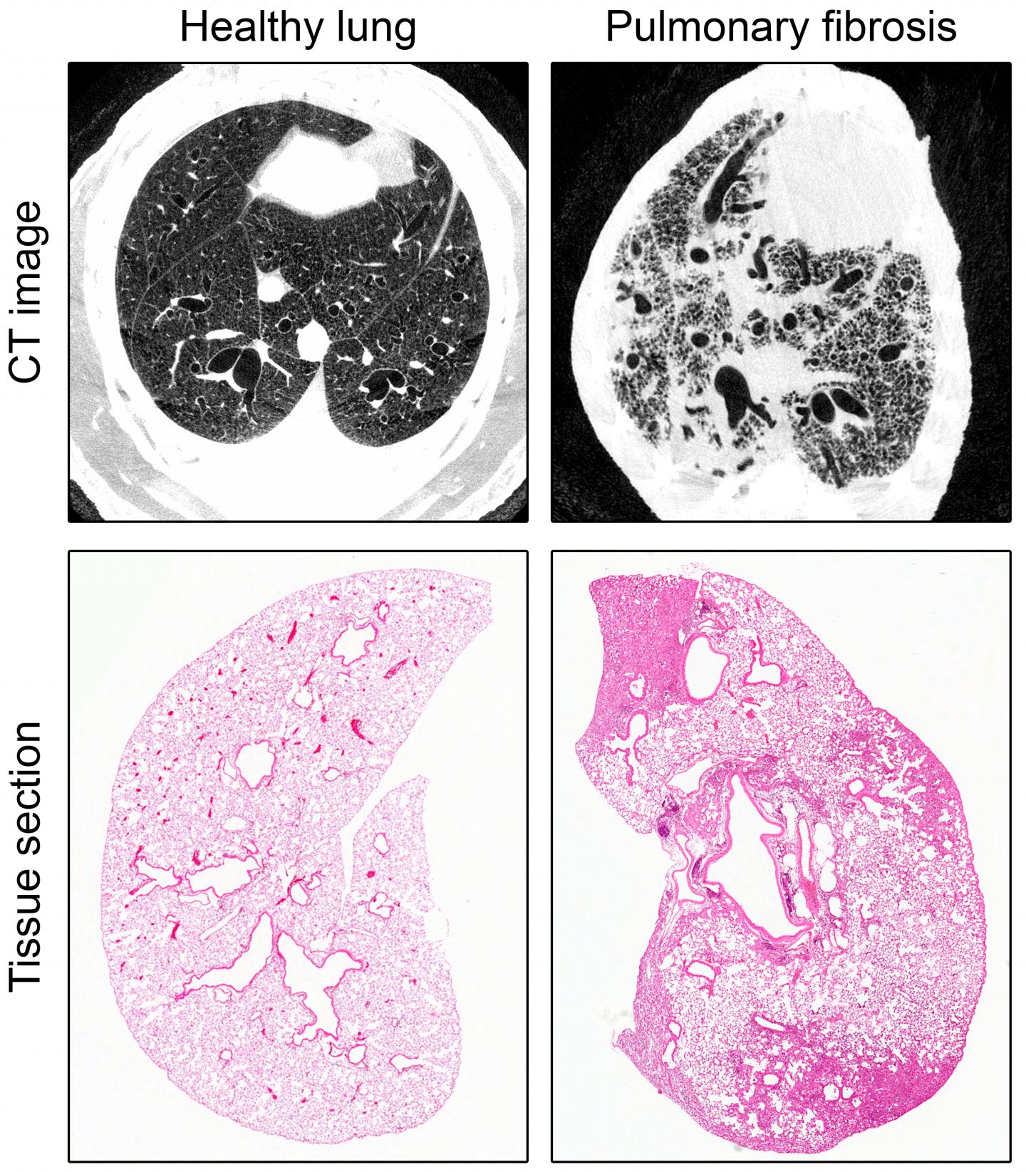 An Animal Model of Severe Pulmonary Fibrosis