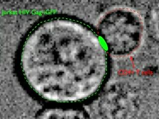 Watching HIV Jump from Cell to Cell (2 of 6)